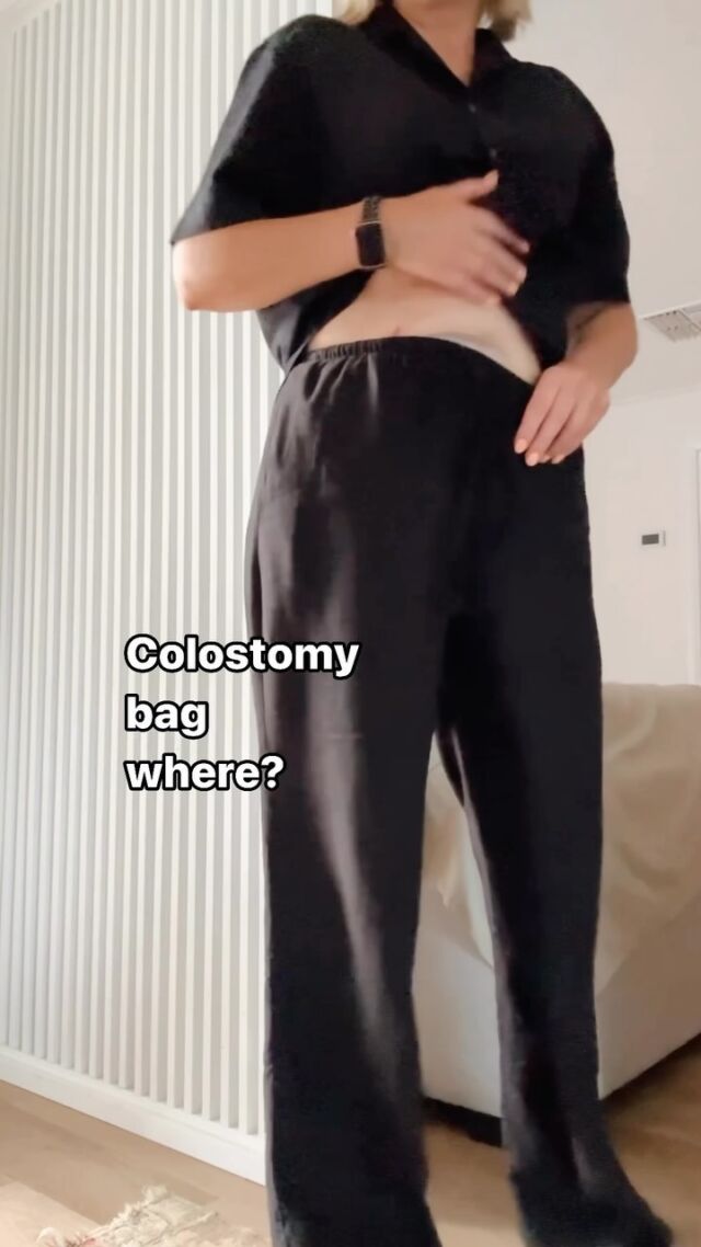 Always soldiering on… 

Grateful for this bag and always trying to be positive.

#colostomy #colostomybag #ostomate #crohns #crohnsdisease #protectomy #worldibdday #worldibdday2024